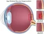 Medical Retina Management Ophthalmologist In New Castle Johannesburg Dr Junaid Zondi
