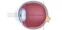 Myopia Ophthalmologist In New Castle Johannesburg Dr Junaid Zondi Sa Myopia Ophthalmologist In New Castle Johannesburg Dr Junaid Zondi Sa