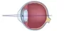 Presbyopia Ophthalmologist In New Castle Johannesburg Dr Junaid Zondi Presbyopia Ophthalmologist In New Castle Johannesburg Dr Junaid Zondi